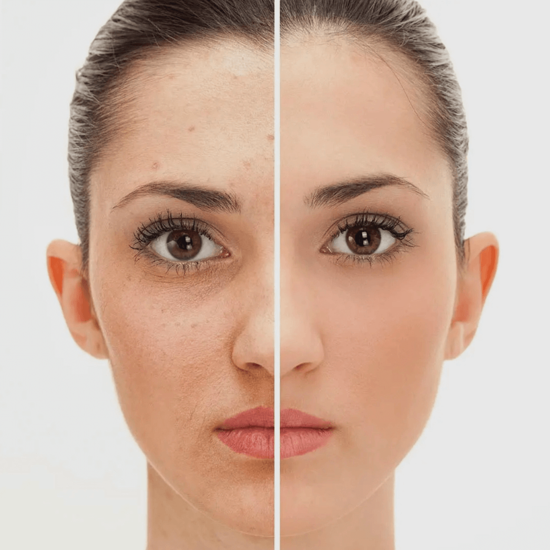 Avant et après utilisation du Sérum concentré apaisant au β-glucane Magnolia Orchid USA