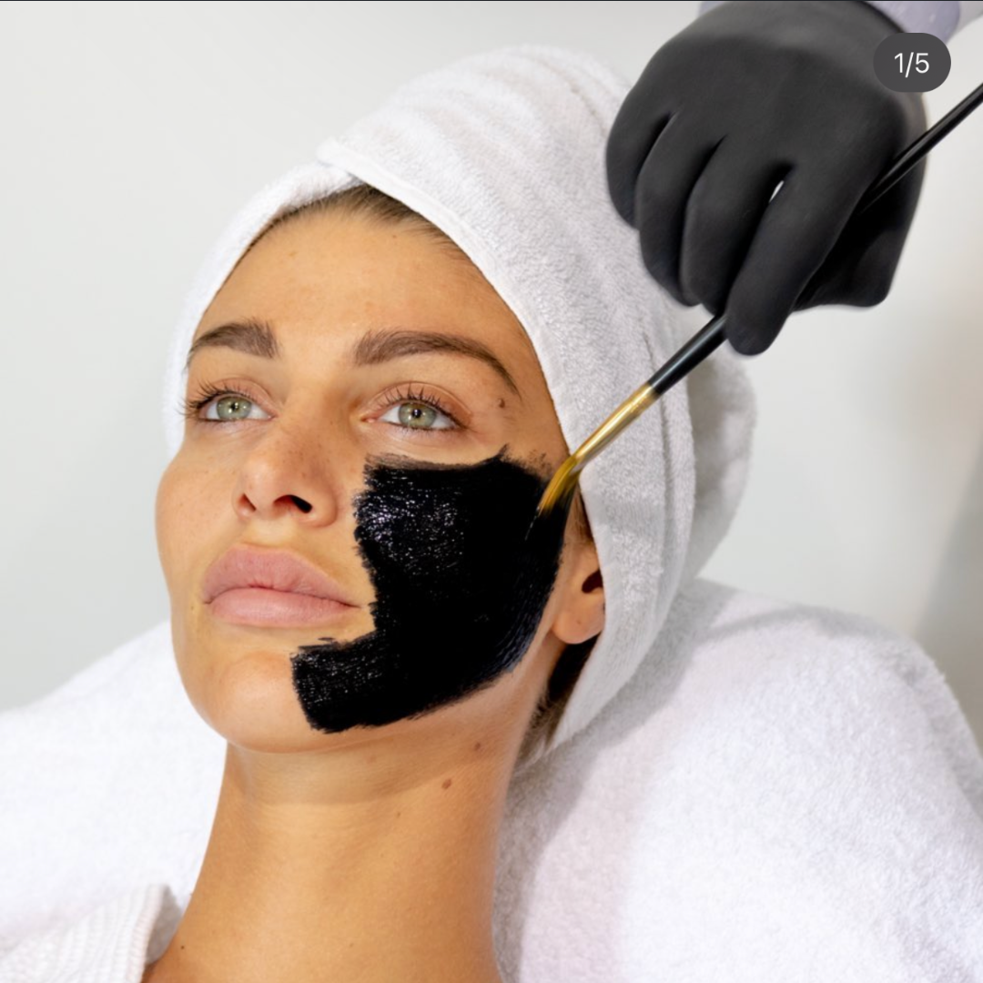 Application du masque Peeling V Carbon avec un pinceau par un professionnel. Soin du visage pour une exfoliation en profondeur.
