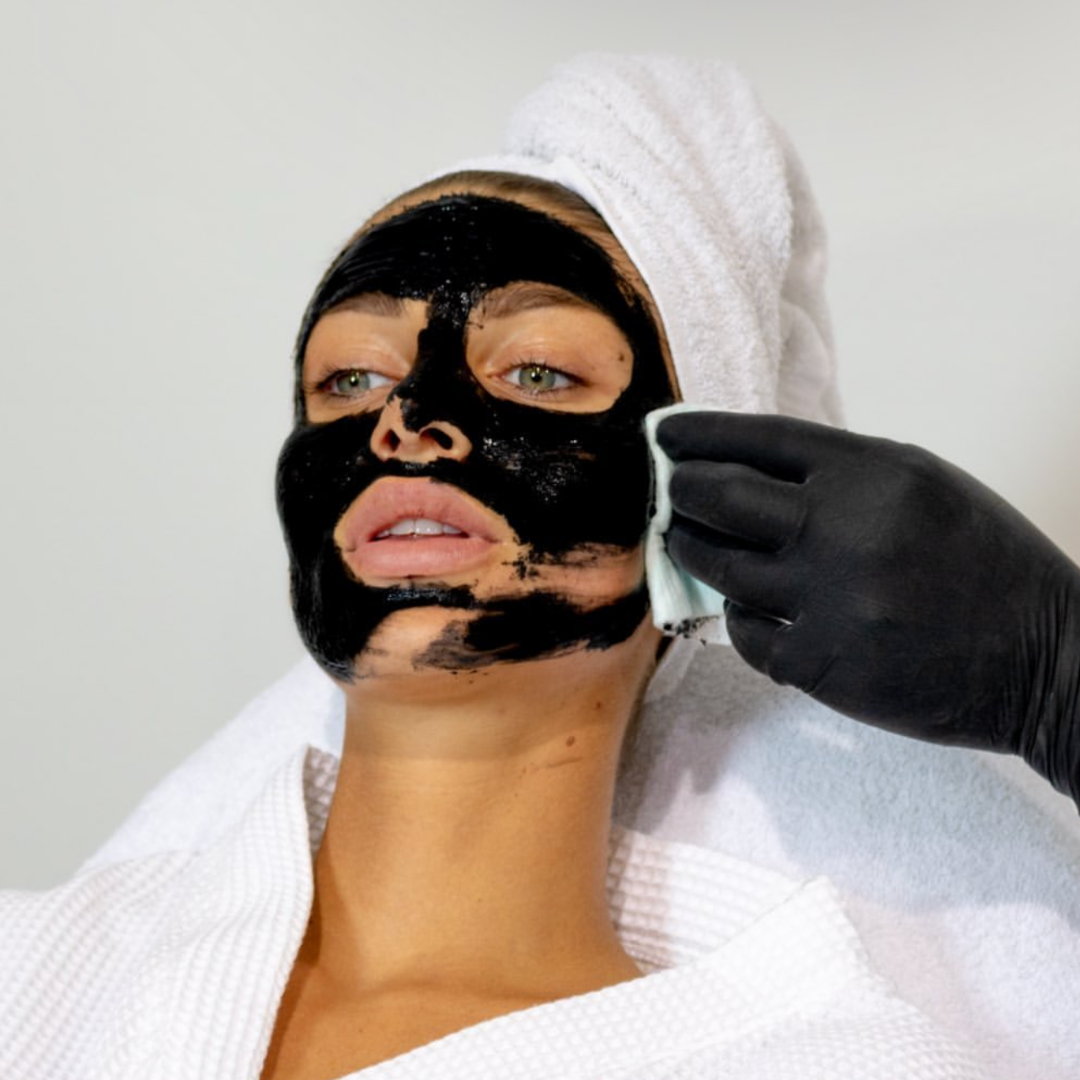 Retrait du masque Peeling V Carbon par un professionnel. Soin du visage pour une peau purifiée et régénérée.