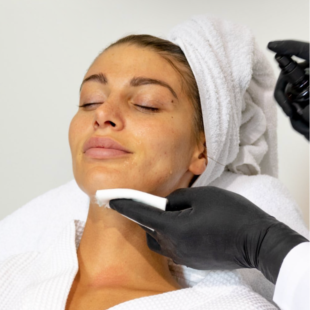Étape finale du soin Peeling V Carbon avec application d'un spray apaisant. Hydratation et éclat pour une peau revitalisée.