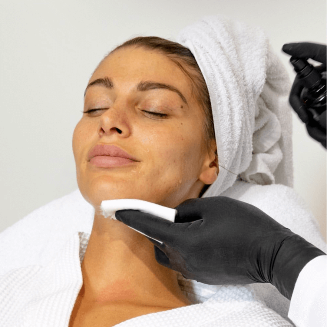 Étape finale du soin Peeling V Carbon avec application d'un spray apaisant. Hydratation et éclat pour une peau revitalisée.