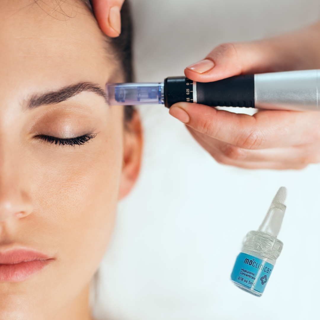 Kit Complet Microneedling avec appareil professionnel appliqué sur le visage, accompagné de sérum hydratant. Idéal pour soins esthétiques avancés.