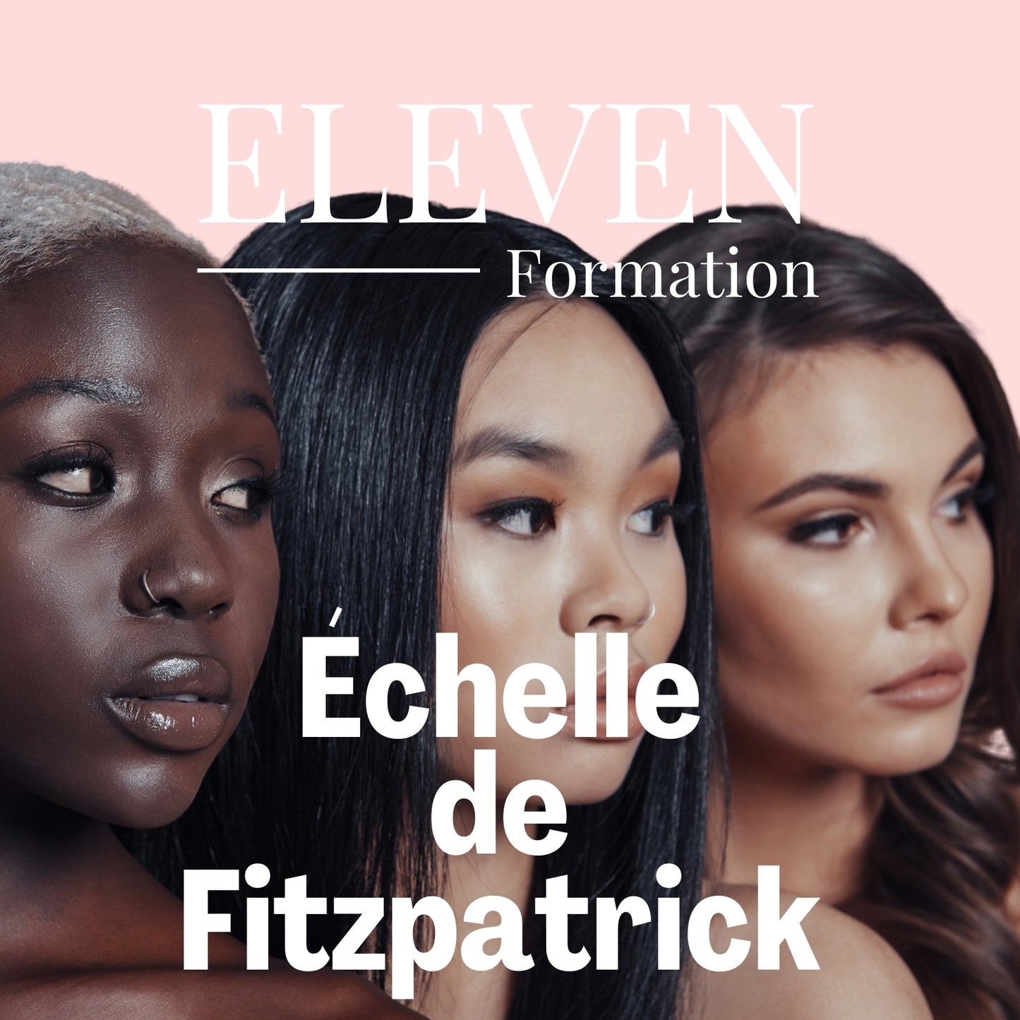 ÉCHELLE DE FITZPATRICK