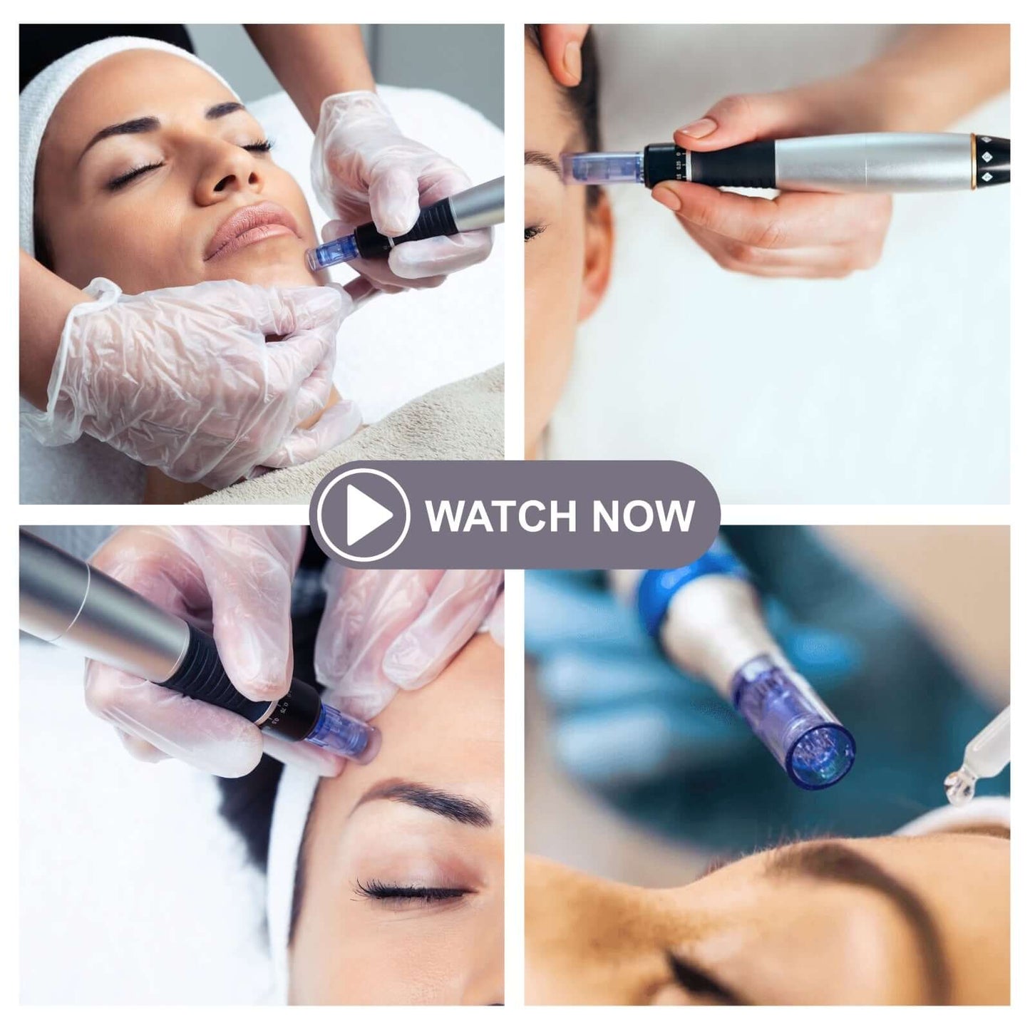 Formation Microneedling + Kit complet avec appareil, technique de soin du visage avancée en institut.