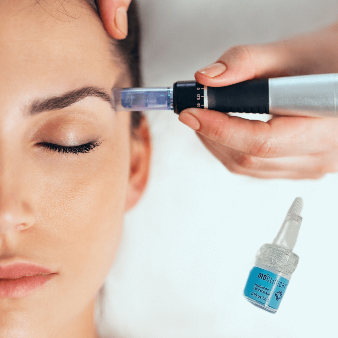 Kit Complet Microneedling en action avec appareil Dr Pen et produit de soin sur peau de cliente.