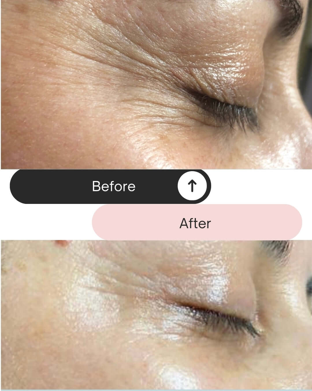 Formation Lifting coréen + Kit produits complet